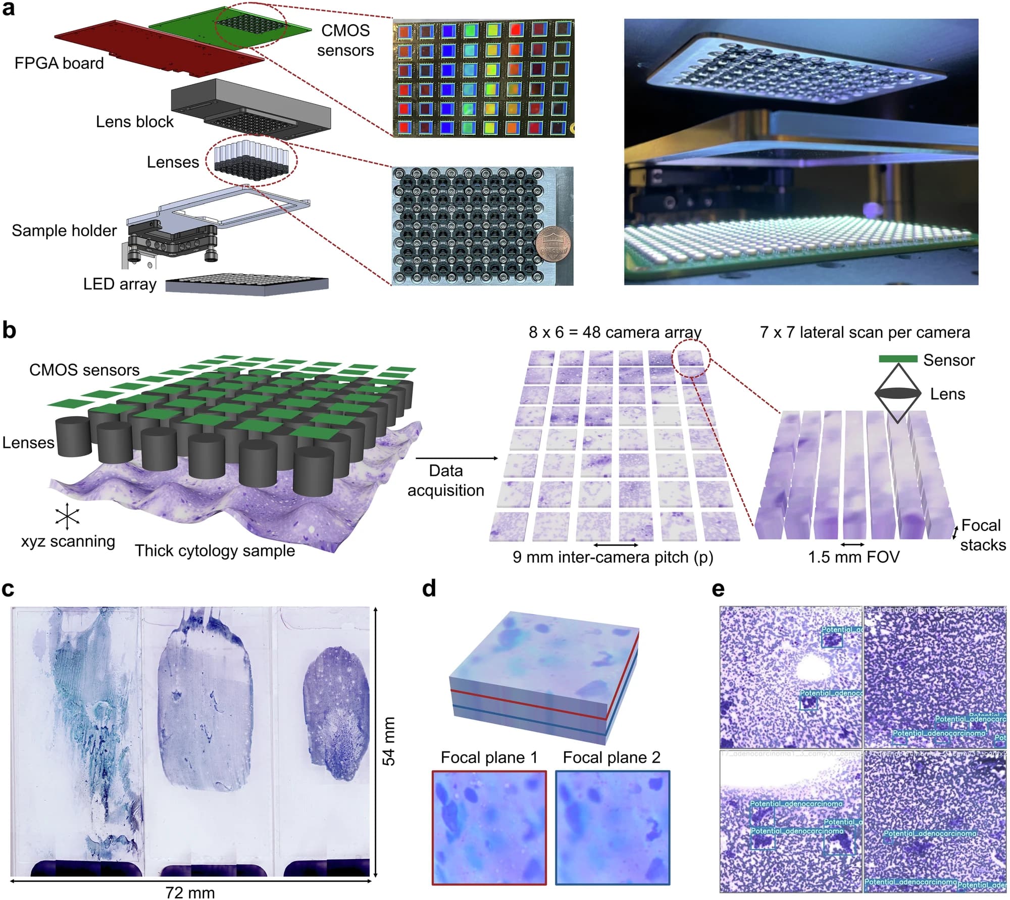 Rapid 3D imaging at cellular resolution for digital cytopathology with a multi-camera array scanner (MCAS)