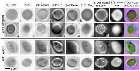Thin-smear blood cells under different forms of illumination example images
