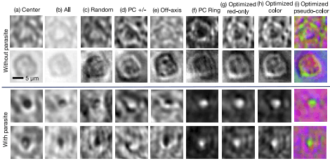 Thick-smear blood cells under different forms of illumination example images