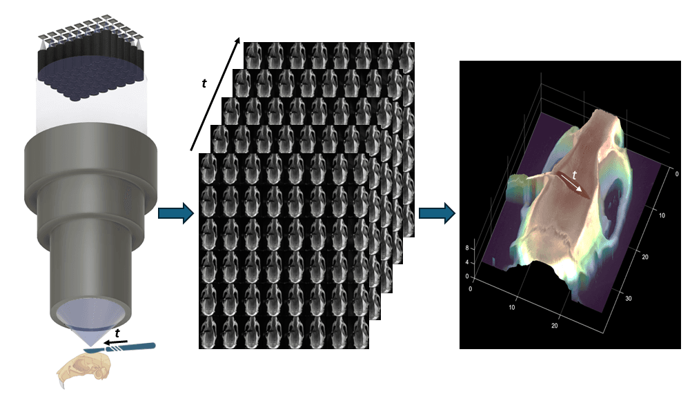 Fourier lightfield multiview stereoscope for large field-of-view 3D imaging in microsurgical settings